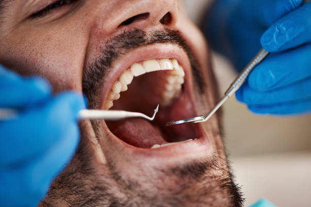 Best Weekend Emergency Dentist in Lovington, IL