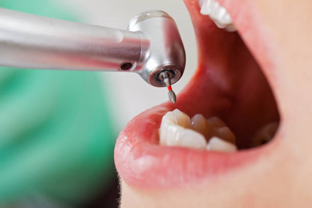 Best Pediatric Emergency Dentist in Lovington, IL